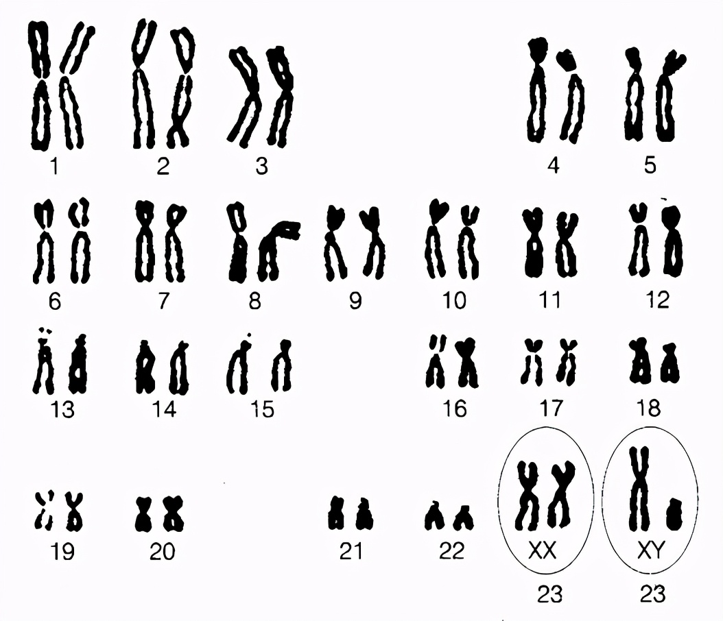 生男还是生女由什么决定,生男生女由谁决定性别