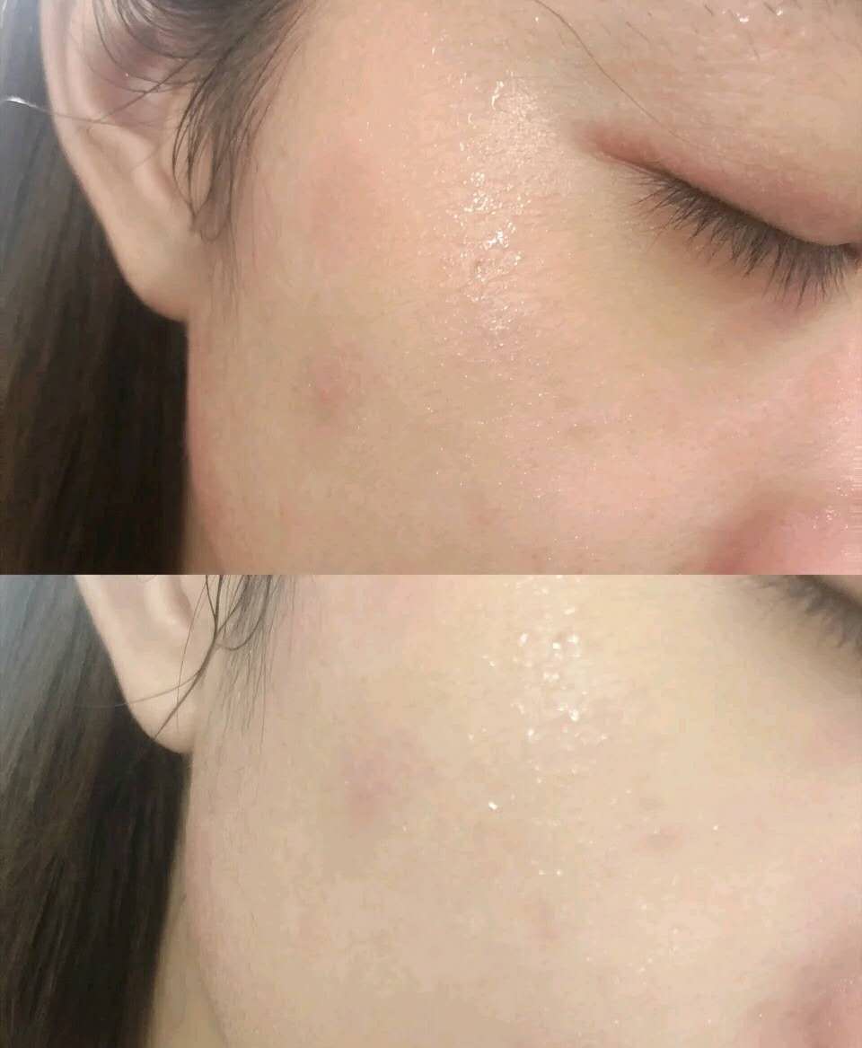 张艺兴国货代言,张艺兴代言面膜推荐