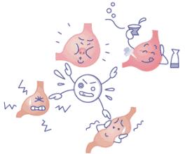 为什么感觉食管堵得慌吐酸水,经常呕吐食道反流