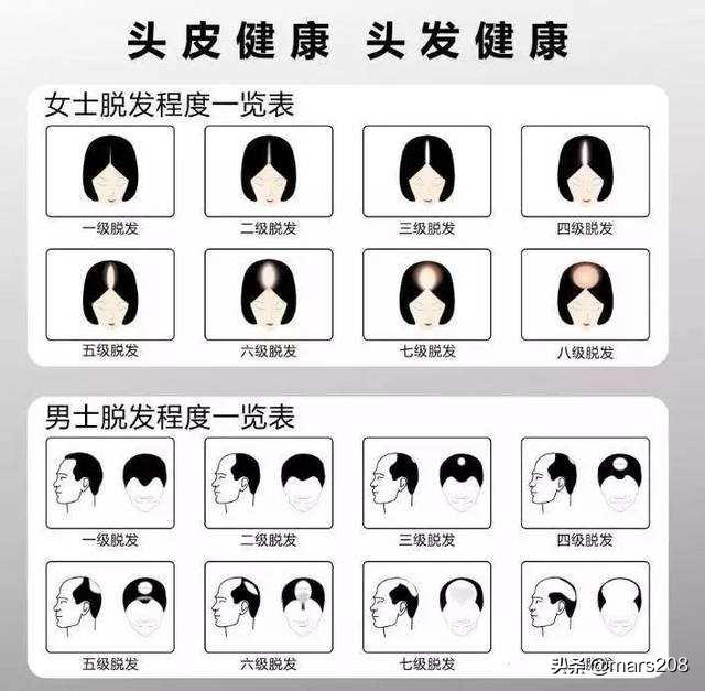 保护发际线的洗发水测评,保护发际线洗发水测评