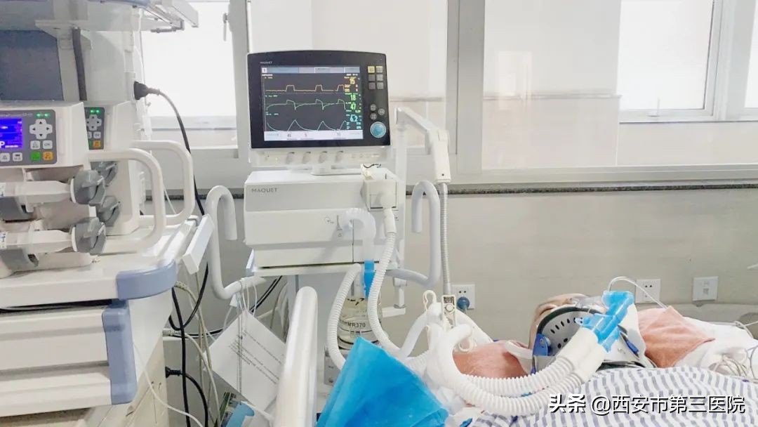 icu呼吸机原理,医学科普icu