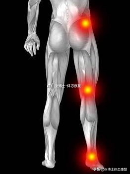 运动膝关节疼痛自我治疗方法,髌骨疼痛综合征康复训练