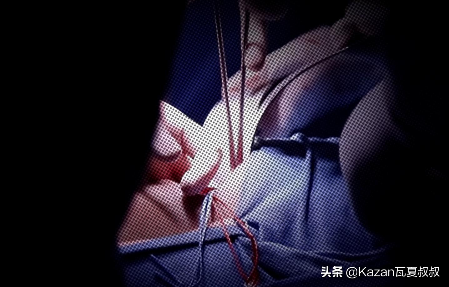 尼泊尔“卖肾村”，穷人们以500美元“高价”和*市黑**做交易换钱