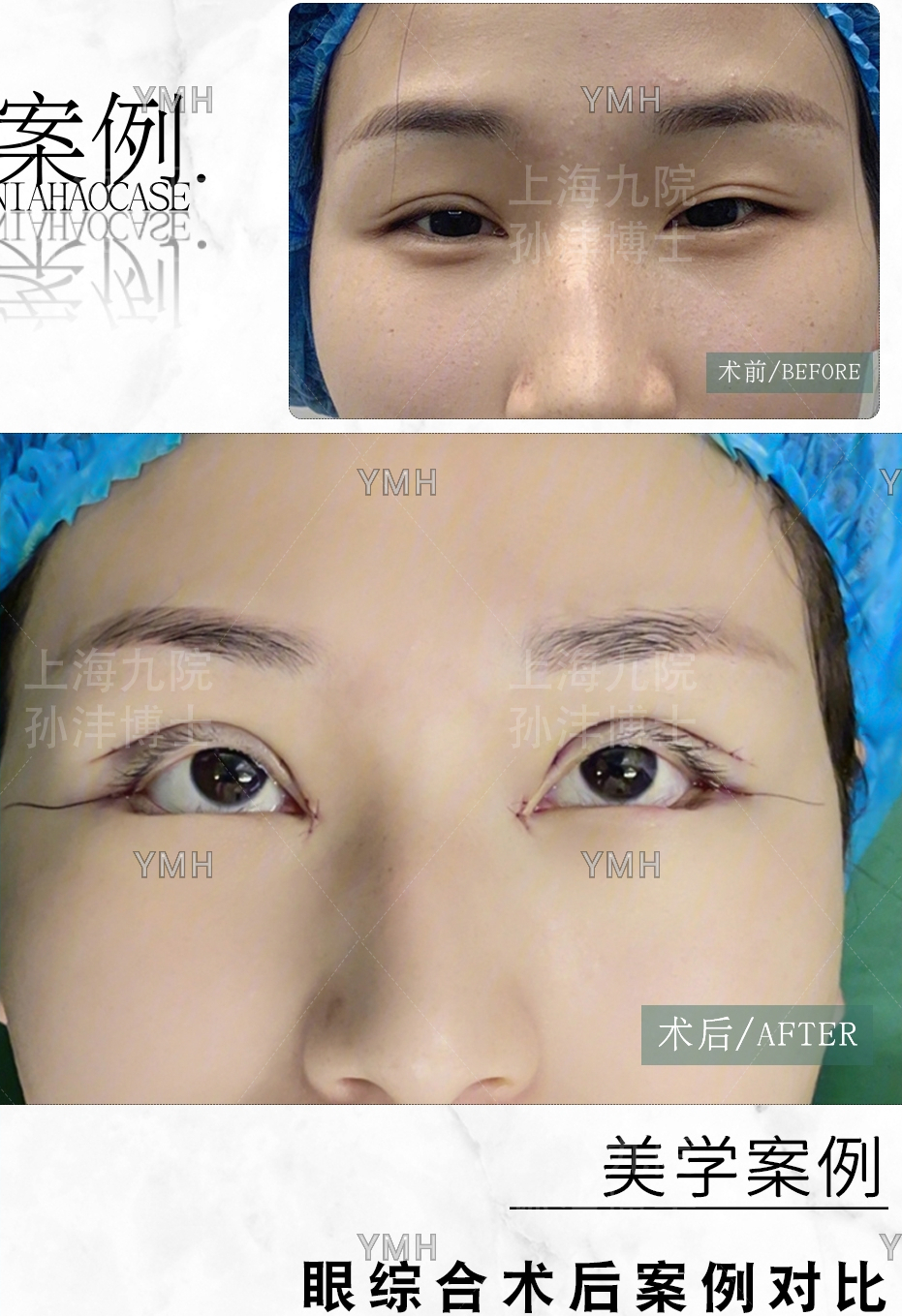 上海九院美容科孙沣,上海九院博士孙沣