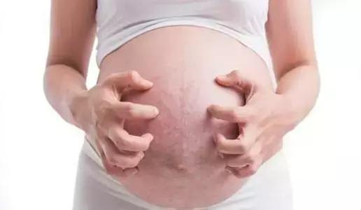 孕期分泌物多会不会有什么问题,孕期分泌物突然增多是怎么回事