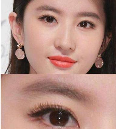 为啥三甲医院做的双眼皮更美,南华博士含金量