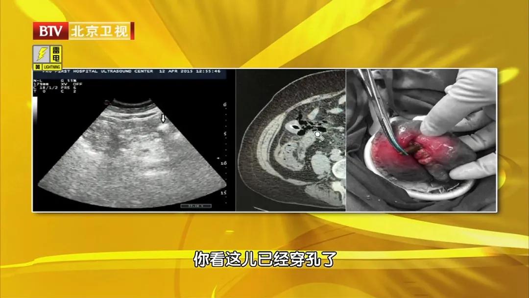 大枣提气血和什么一起吃,大枣怎样吃对女人有好处