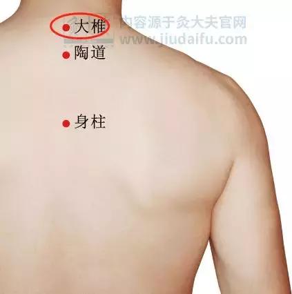 颈椎包夺命包富贵包,颈椎富贵包怎么解决