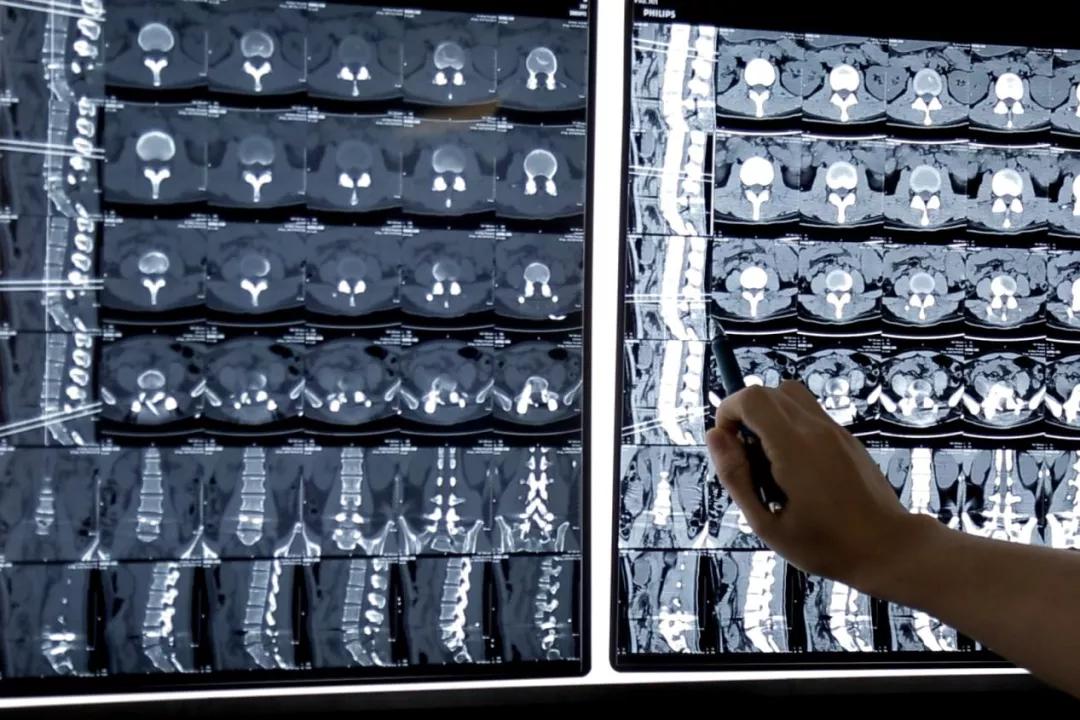 撸串引起的病症,撸串引发的事