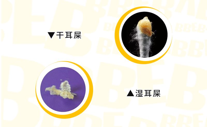 情侣之间“舔耳朵”的风险很大：小心鼓膜穿孔、听力下降