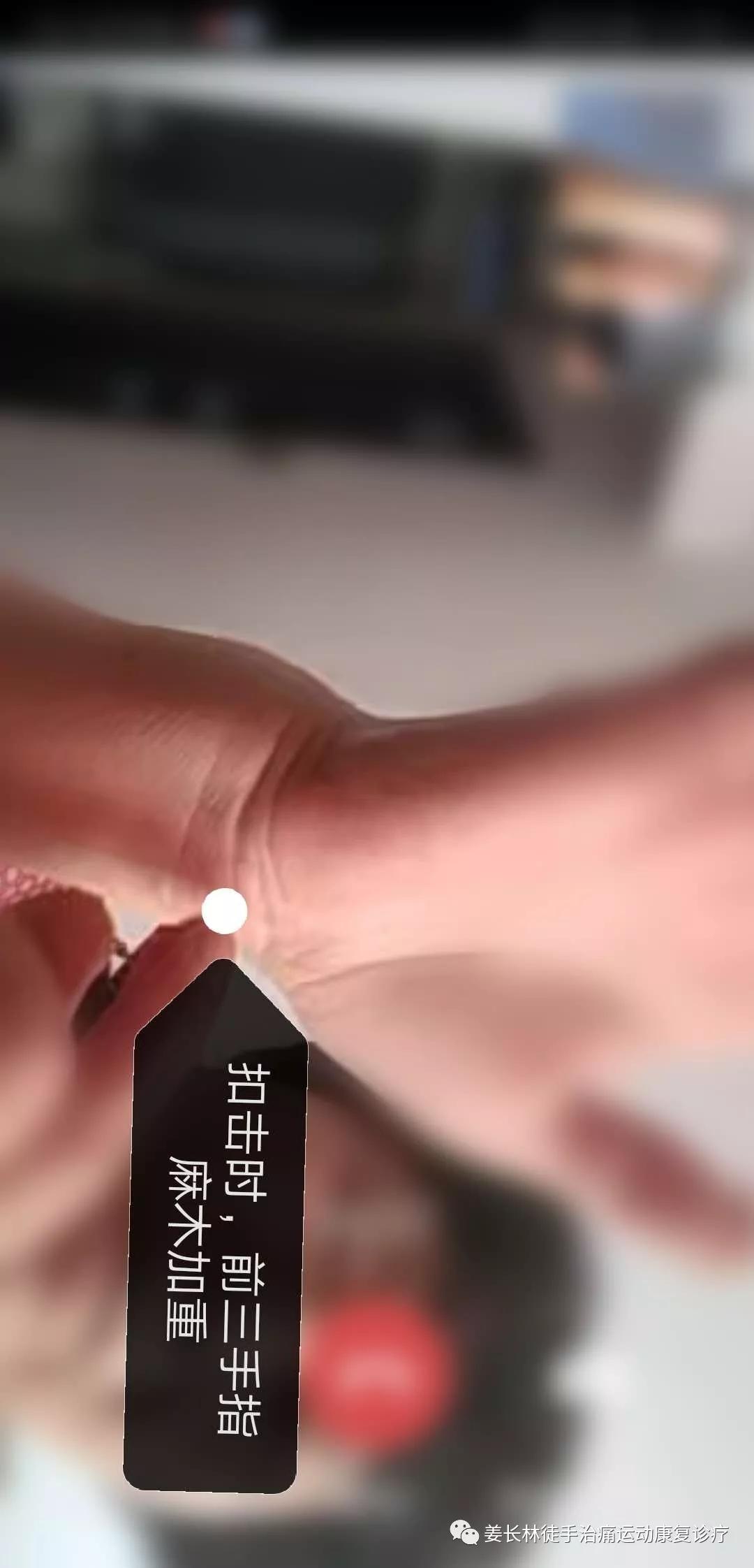 日常生活中的疼痛1—手麻（长时间玩手机）的判断和自我纠正