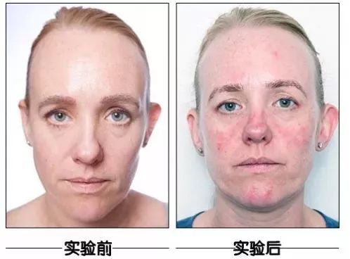 不会卸妆，你抹1万元一瓶的乳液，擦18层精华都没用