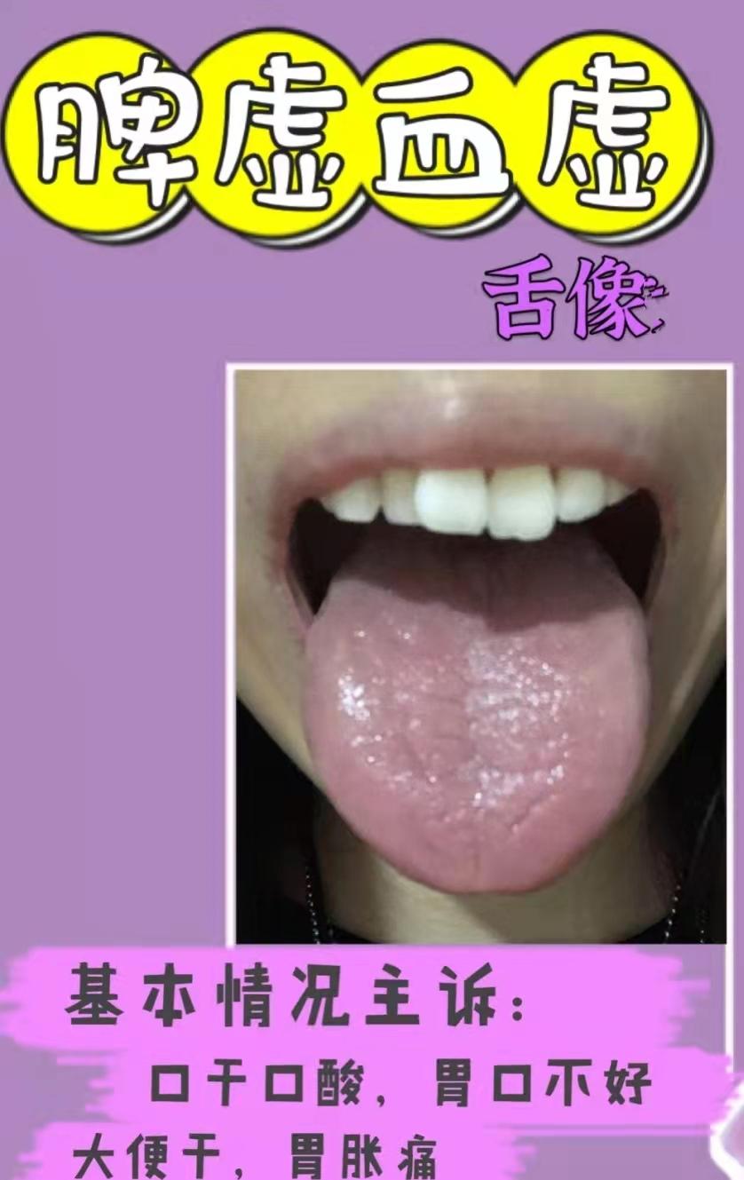 脾胃虚健脾胃的中药,十种健脾胃的中成药该如何调理