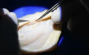 医学缝针练习,医生如何练习缝针