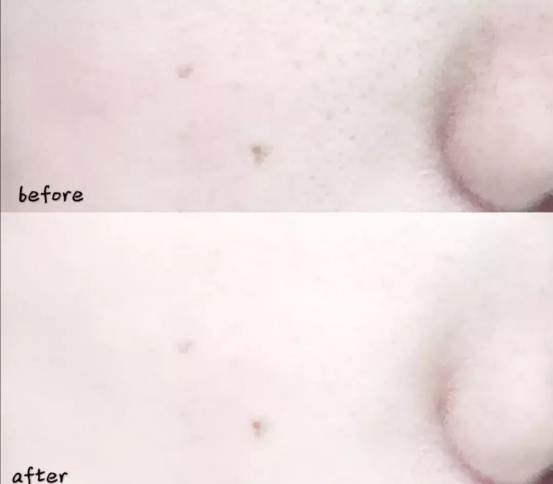 这些护肤成分不要混着用,护肤成分没选对会烂脸