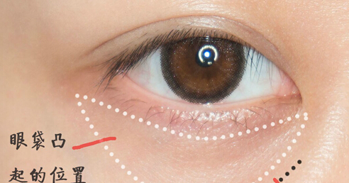 有一种整容叫美颜,有一种整容叫长大