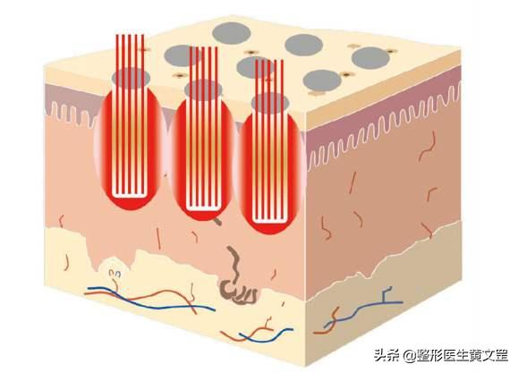 祛疤痕一站式修复,疤痕修复能完美吗