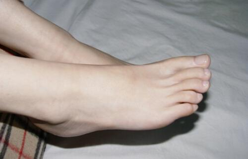 脚肿要警惕四种病手突出一块,脚肿要警惕四种病可以用醋擦吗