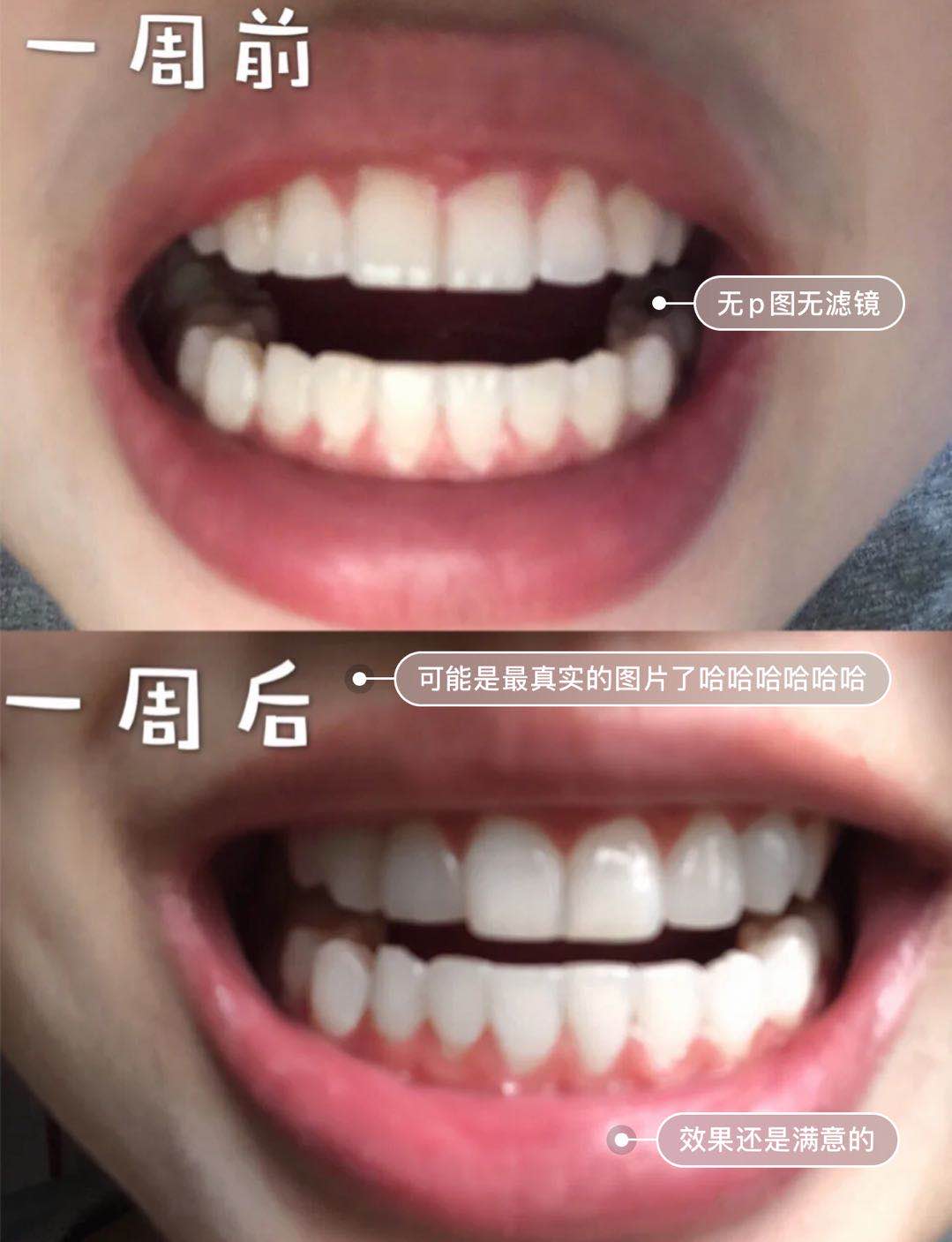 皮肤有点黄的女生会有男生喜欢吗,女生皮肤偏黄男生会喜欢么