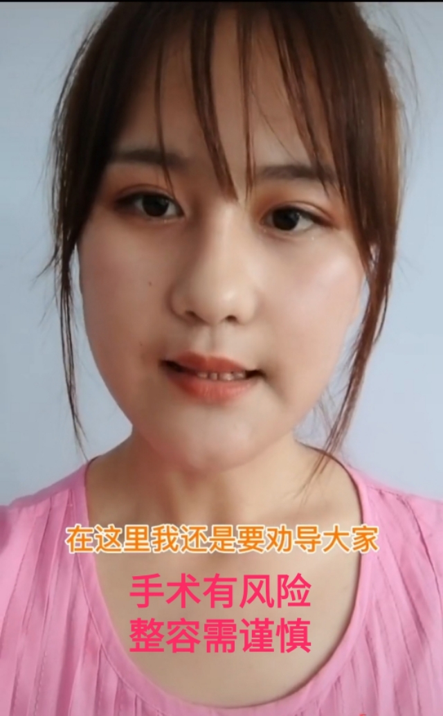 面部畸形整形的女孩,先天面部畸形整形