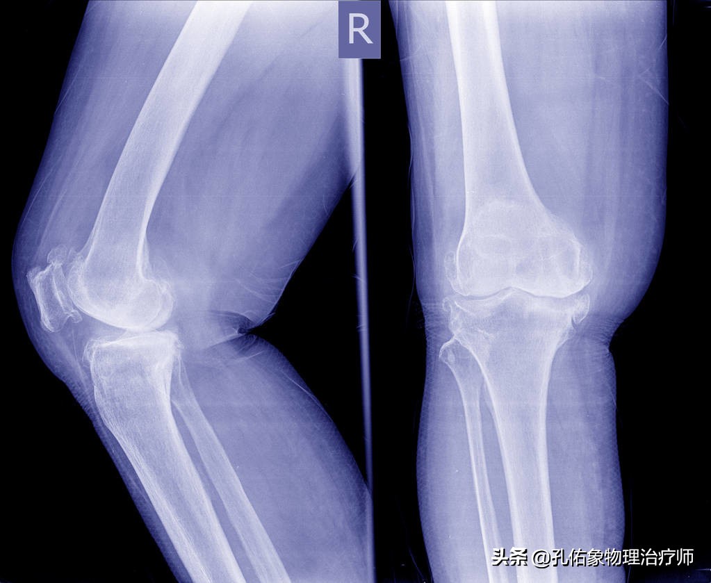 老年人腿脚无力要怎么避免,专治老年人下肢无力的方法