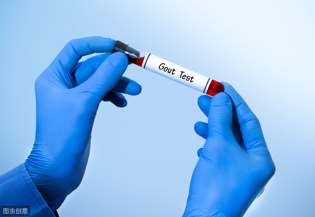 尿酸从5992天降到230,尿酸从555降到326正常不