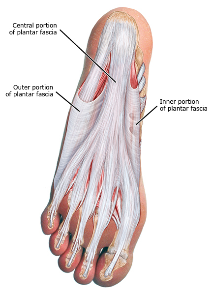 医学科普骨科足底筋膜炎,筋膜炎科普