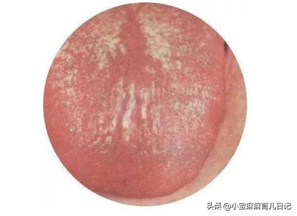 孩子缺锌影响专注力吗,宝宝缺锌吃什么补锌会影响长高吗