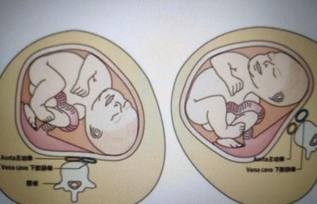 岳云鹏老婆再剃光头,岳云鹏老婆为什么剃光头