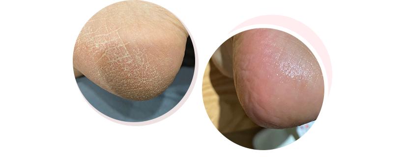 鞠式美妆思路,女鬼式美白法