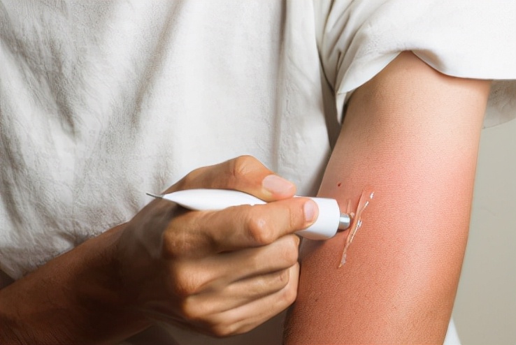 红霉素软膏在眼部涂,红霉素软膏除了涂眼还能涂哪里