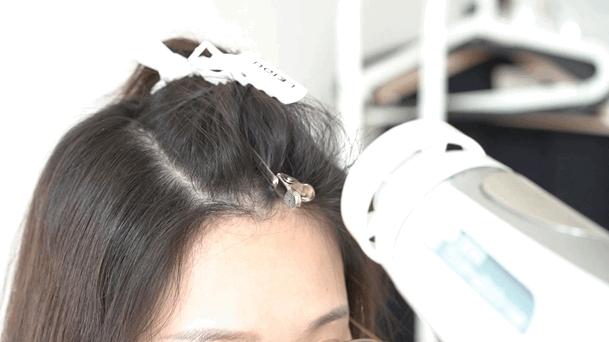 头型尖怎么整容,头型太丑什么发型能补救