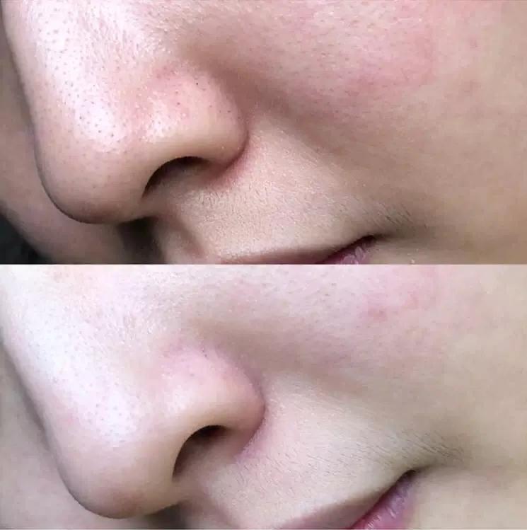 扒一扒米蓓尔面膜,扒一扒谷雨面膜