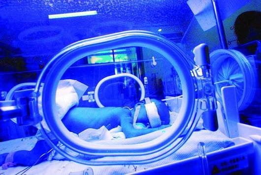 刚出生宝宝黄疸高要住院吗,刚出生宝宝黄疸高危险吗