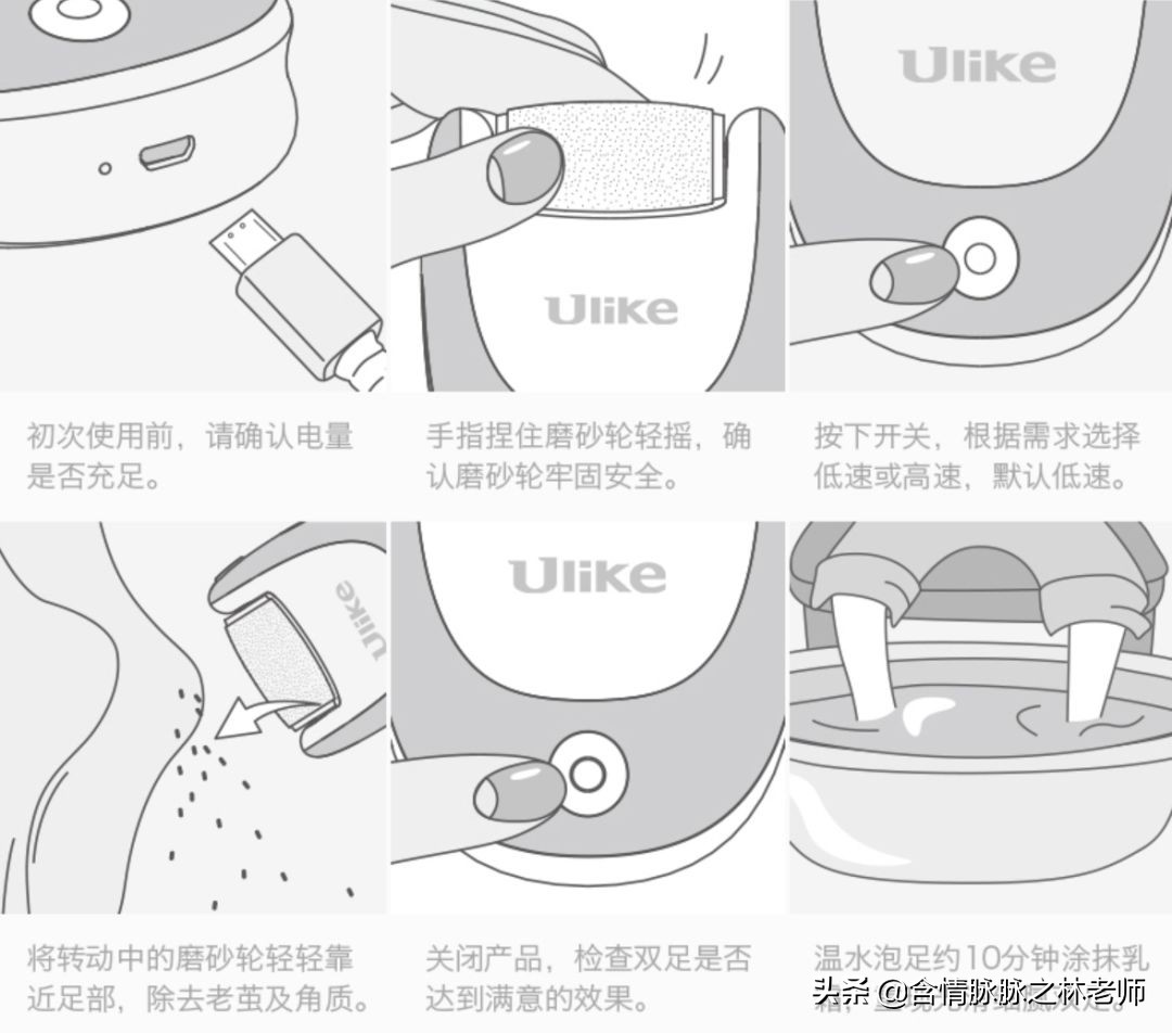 给你一双水嫩的脚趾，Ulike磨足器使用体验