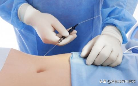 溶脂针有红溶脂针和绿溶脂针吗,溶脂针有效果吗有副作用吗