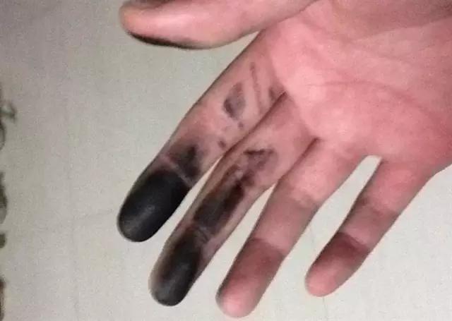 清积碳的套路,清积碳是真是假