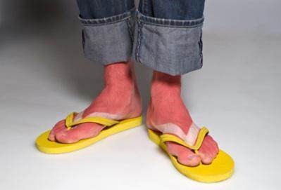 穿人字拖会影响脊椎吗,穿人字拖会导致畸形脚吗