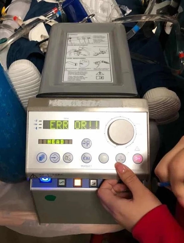 ecmo界面及报警介绍,ecmo故障及处理