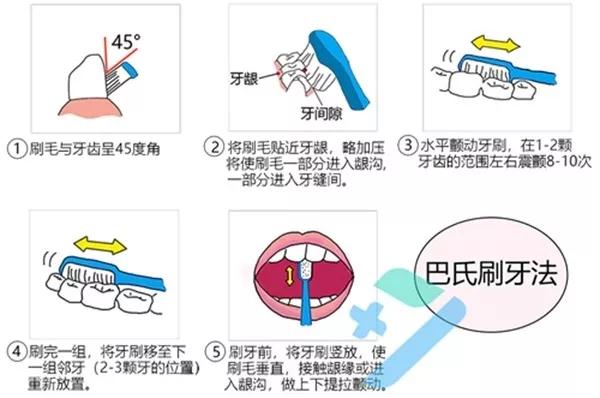 牙齿有虫洞要花多少钱,牙齿上的小黑洞是个烧钱的无底洞