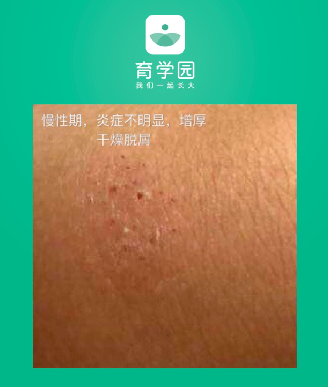 崔玉涛宝宝可以用的激素,崔玉涛谈小安素激素