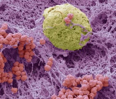 新冠肺炎对症用药指南,新冠肺炎的解读和总结