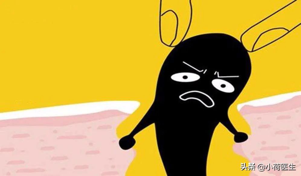 顽固的黑头用祛黑头仪真的能行吗,黑头的成因以及祛黑头的方法