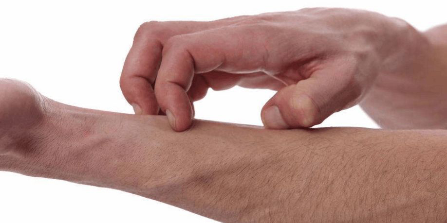 忍痛易忍痒难什么意思,如果觉得痒该如何止痒