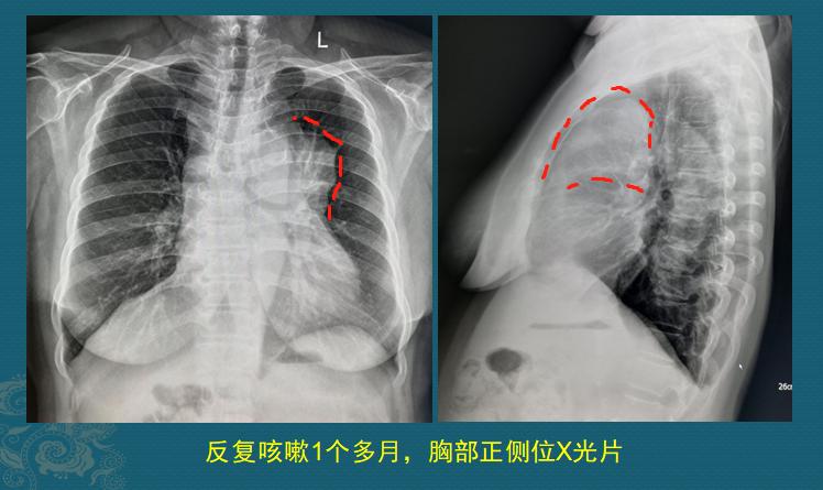 通过健康体检能检查出癌症吗,健康体检是防癌吗