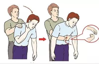 吃东西呛到怎么补救,吃东西呛到了急救方法叫什么