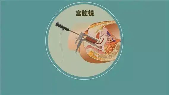 认识石头上的字,认识自我