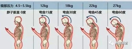 查出颈椎多节病变,颈椎生理曲度稍变直能恢复吗