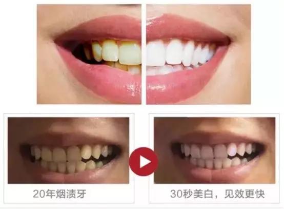 刷牙的正确方法牙不黄不臭,刷牙牙黄变白的最快方法