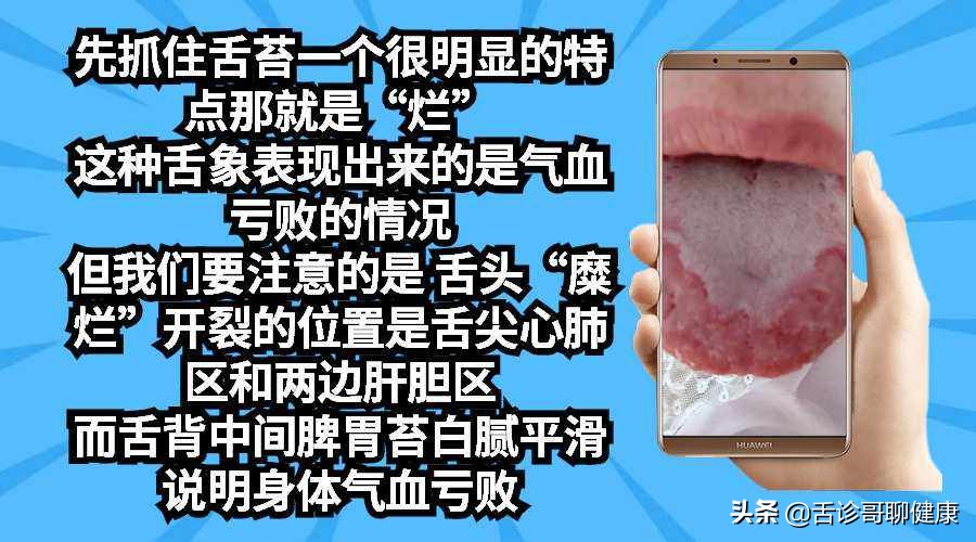 尿路结石口干舌燥恶心,尿路结石导致恶心呕吐不尿尿